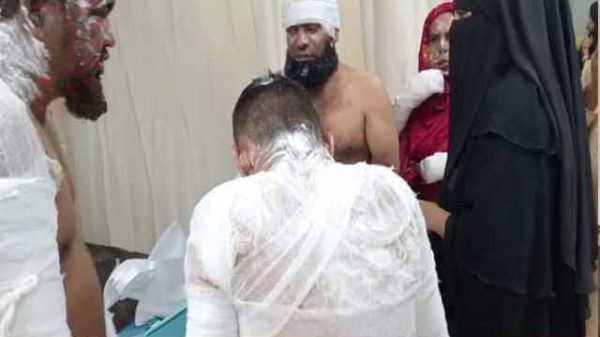 আশুলিয়ায় গ্যাস লিকেজে ভয়াবহ বিস্ফোরণ,