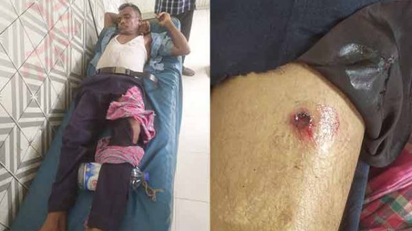 চাঁদা না দেওয়ায় শিক্ষকের উপর গুলি বর্ষণ!