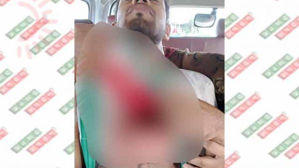 ছুরিকাঘাতে দোকানদার আহত