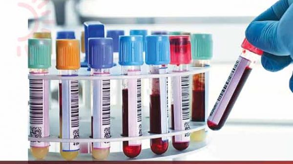 রক্তের গ্রুপ মিলে গেলেই কি সব ঠিক হয়ে যায়