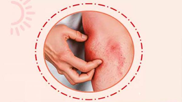 ঘুমাতে গেলেই চুলকানি