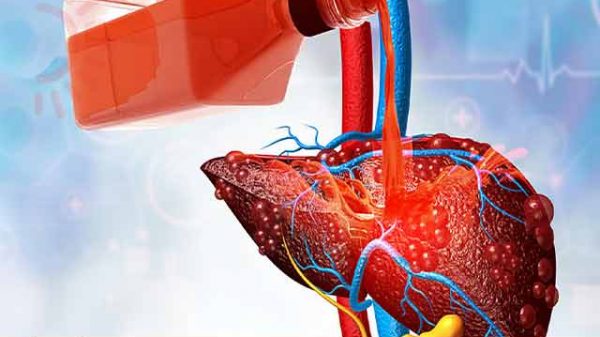 লিভার নষ্ট