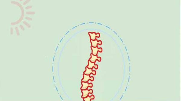 বিপজ্জনক স্কোলিওসিস
