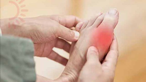 ইউরিক এসিড